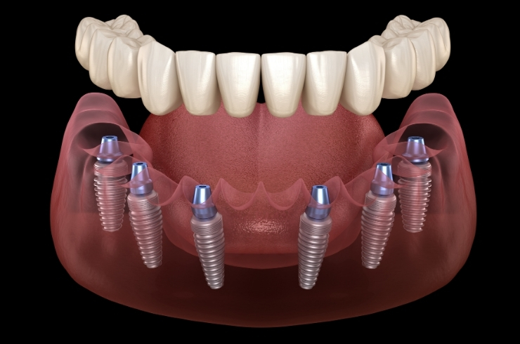 Jubilee Dental Care